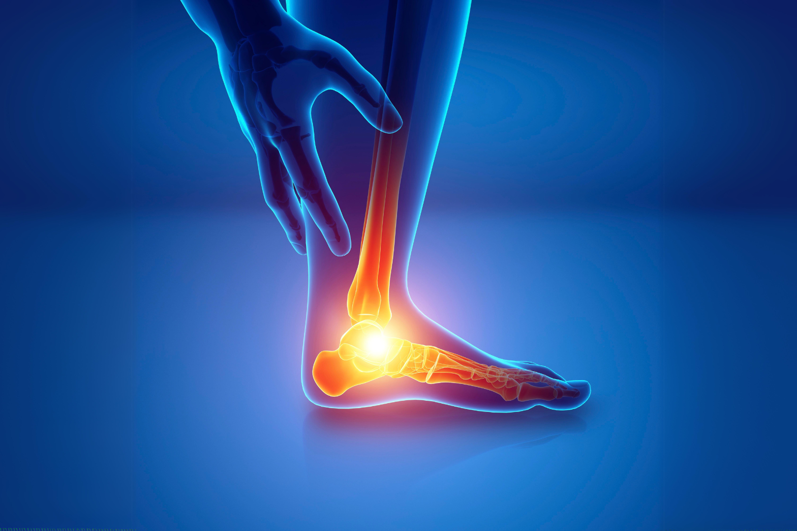 What is Plantar Fasciitis